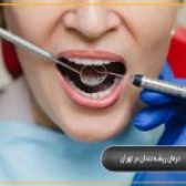 درمان ریشه دندان در تهران