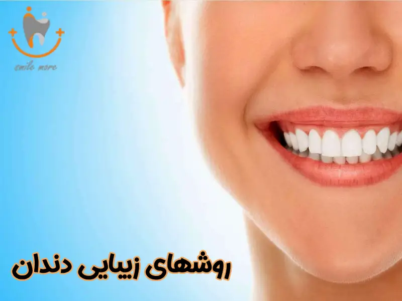 بهترین روش های زیبایی دندان