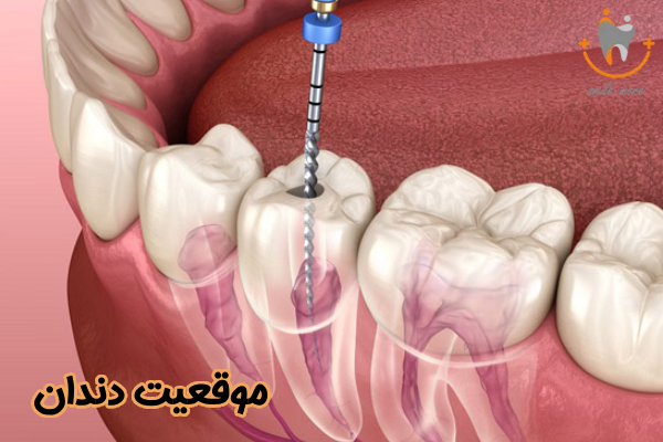 موقعیت دندان
