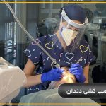 عصب كشي مجدد دندان در تهران