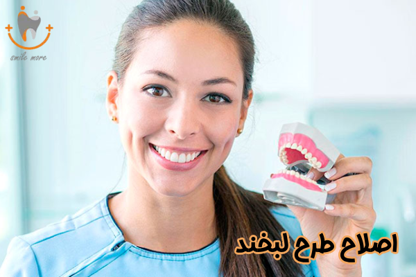 اصلاح طرح لبخند چیست