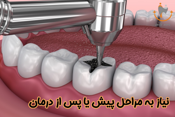 نیاز به مراحل پیش یا پس از درمان
