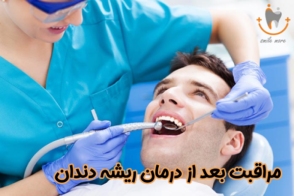مراقبت بعد از درمان ریشه دندان