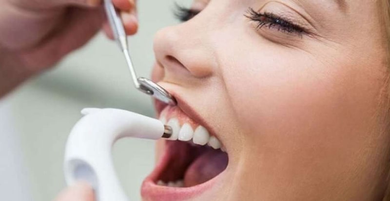 ایا جرم گیری دندان را سفید میکند