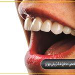 متخصص دندانپزشک زیبایی تهران