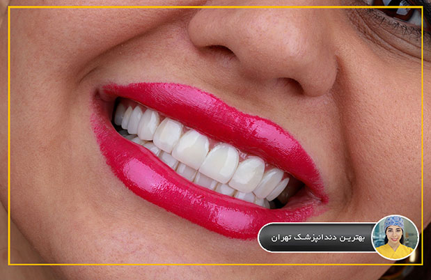 بهترین دندانپزشک تهران را می شناسید؟