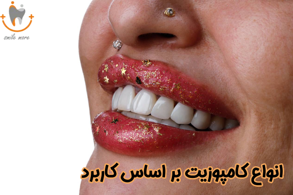 انواع کامپوزیت بر اساس کاربرد