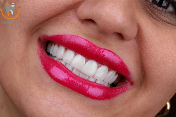 انواع کامپوزیت دندان1