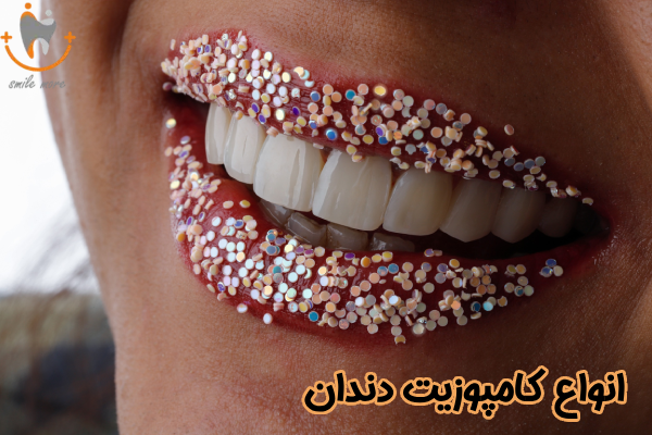 انواع کامپوزیت دندان چیست