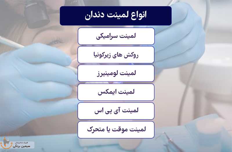 انواع لمینت دندان