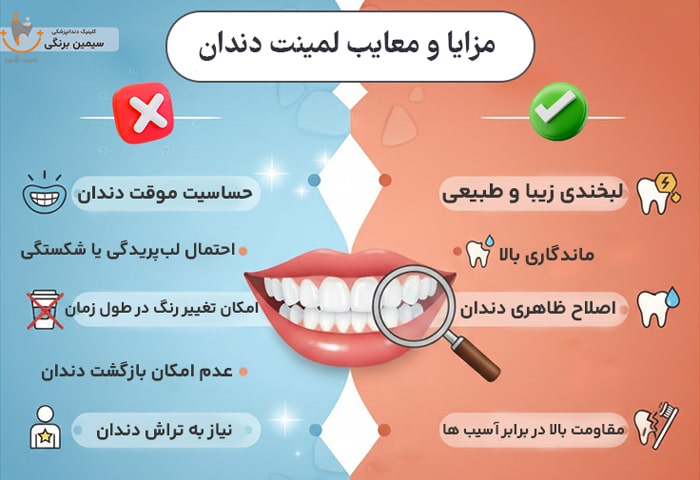 مزایا و معایب لمینت دندان