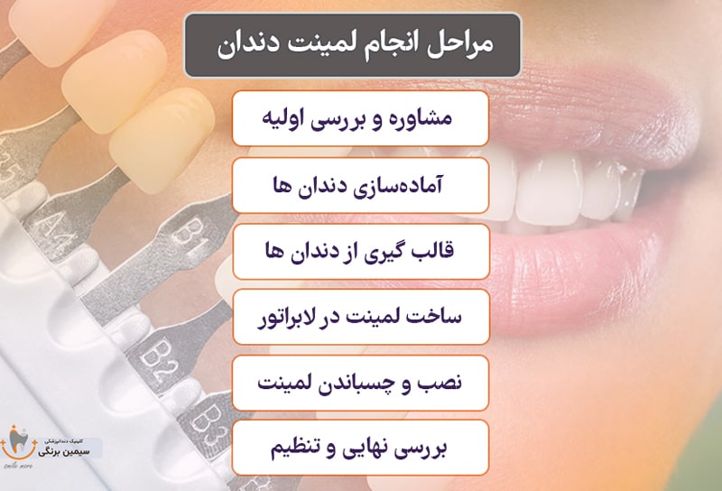 مراحل انجام لمینت دندان