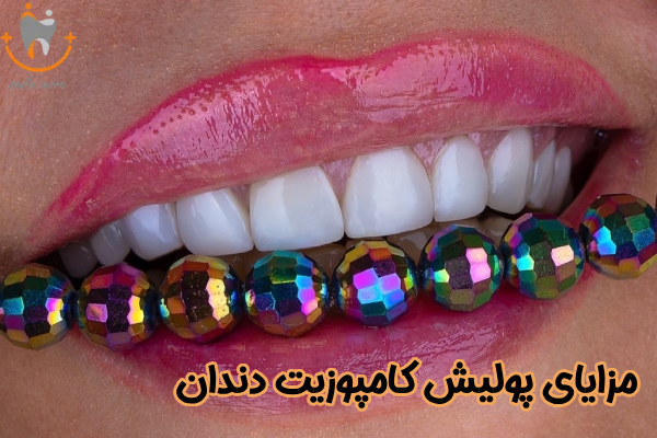 مزایای پولیش کامپوزیت دندان