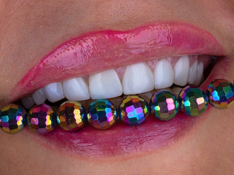 طول عمر کامپوزیت دندان چقدر است