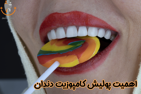 اهمیت پولیش کامپوزیت دندان