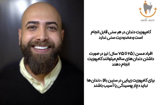 تا چه سنی میتوان کامپوزیت دندان انجام داد؟