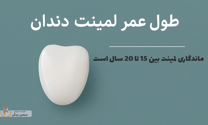 عوامل موثر بر عمر لمینت دندان