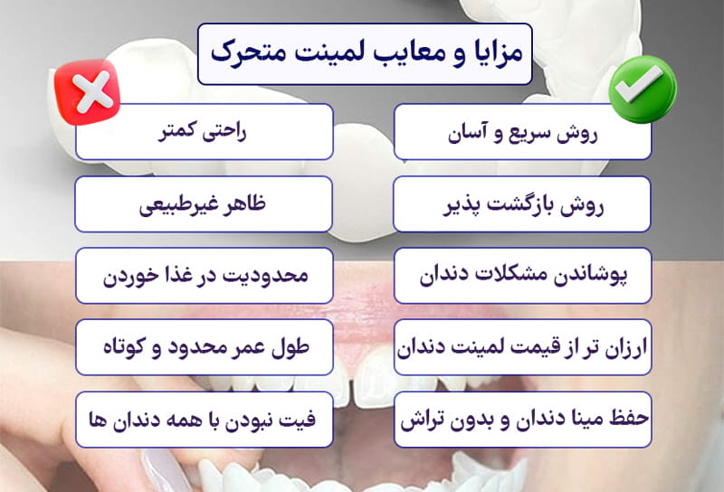 مزایا و معایب لمینت متحرک