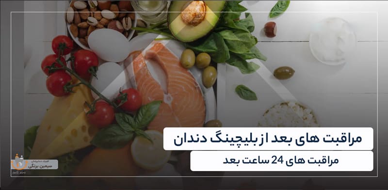 مراقبت های بعد از بلیچینگ