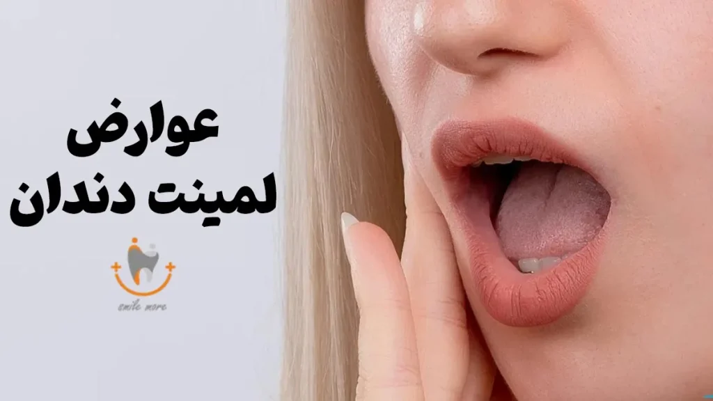 خطرات رایج بعد از لمینت دندان