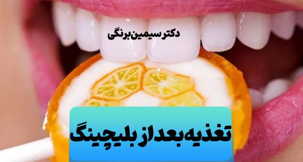 تغذیه بعد از بلیچینگ دندان