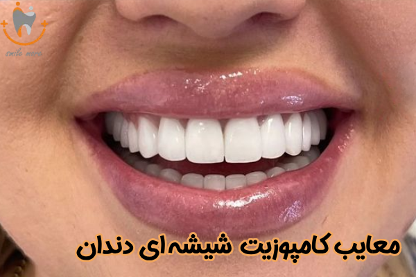 معایب کامپوزیت شیشه ای دندان