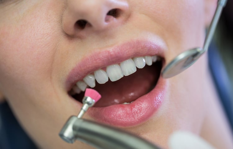 برای زیبایی دندان ها در خانه چه باید کرد؟