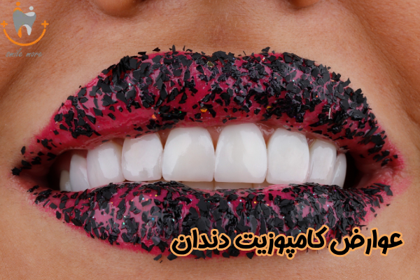 عوارض کامپوزیت دندان
