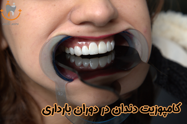 کامپوزیت دندان در بارداری