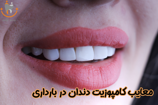 معایب کامپوزیت دندان در بارداری