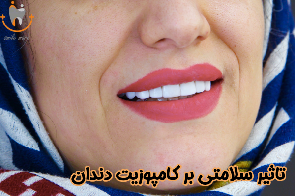تاثیر سلامتی بر کامپوزیت دندان