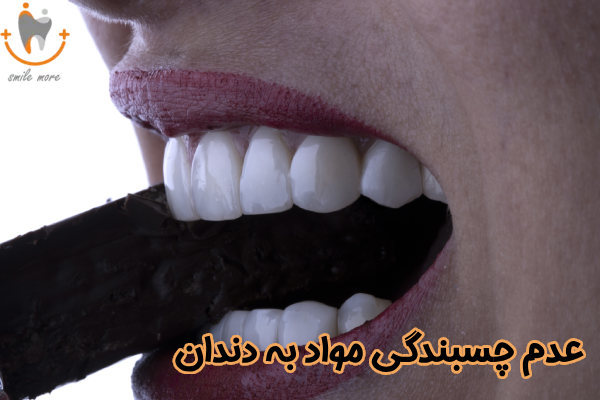 عدم چسبندگی مواد به دندان