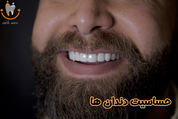 حساسیت دندان ها