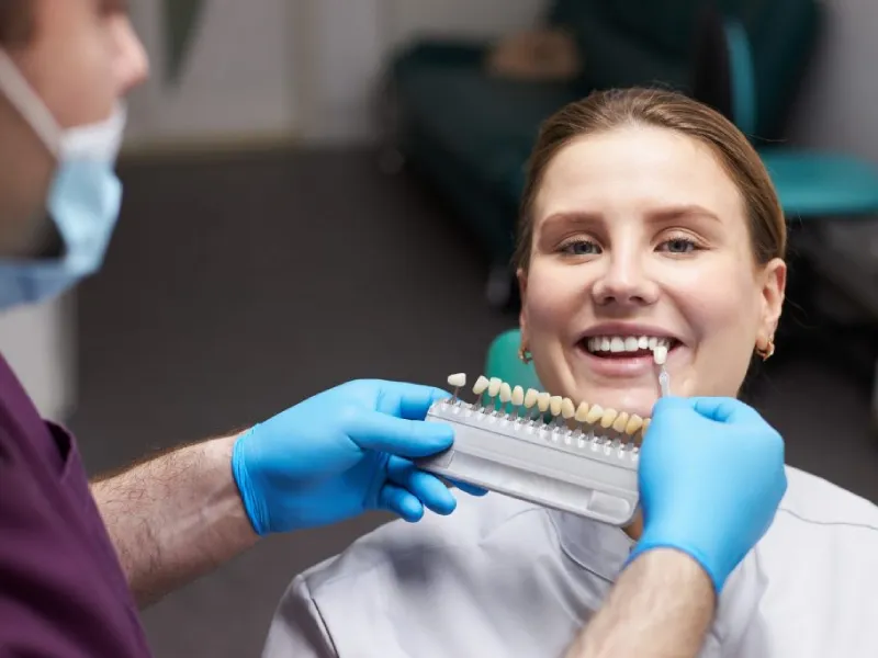 تفاوت لمینت و روکش دندان