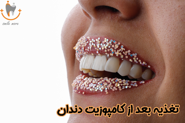 تغذیه بعد از کامپوزیت دندان