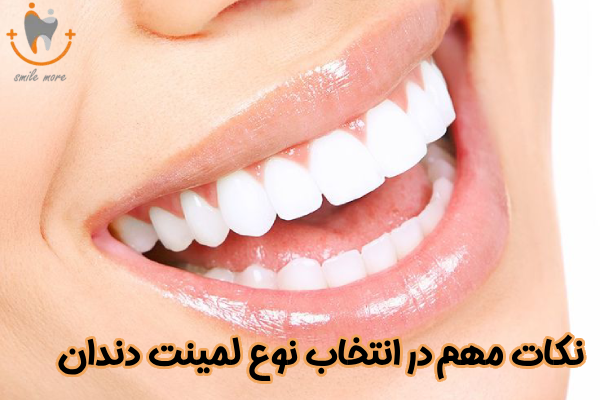 نکات مهم در انتخاب نوع لمینت دندان