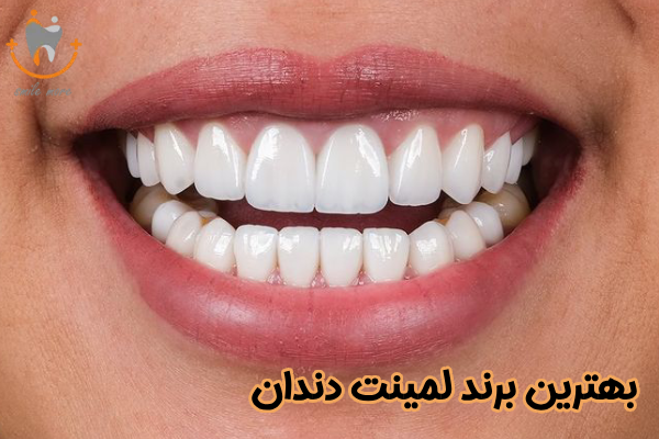 بهترین برند لمینت دندان