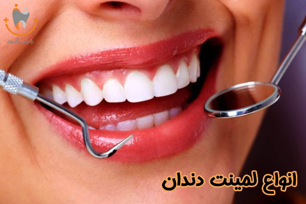 انواع لمینت دندان