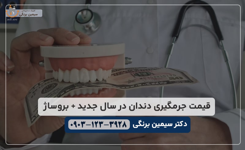 قیمت جرم گیری دندان