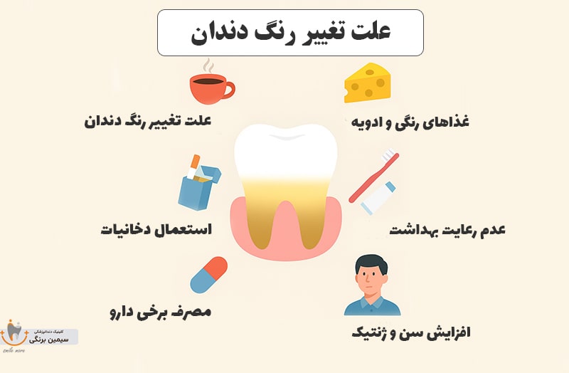 علت تغییر رنگ دندان