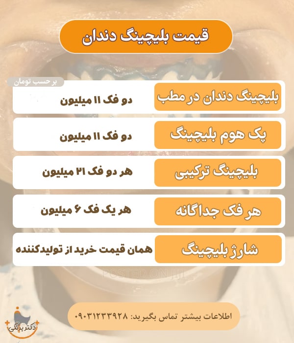 قیمت بلیچینگ دندان