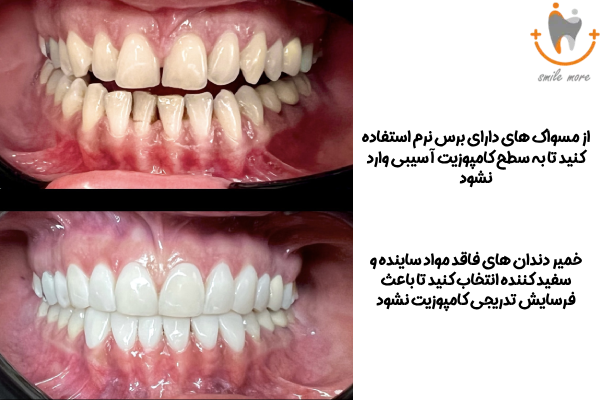انتخاب خمیر دندان