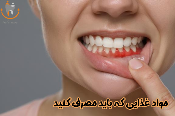 مواد غذایی که باید مصرف کنید