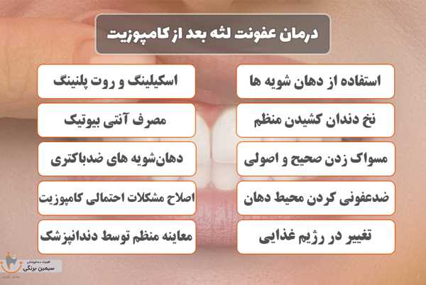 درمان التهاب لثه بعد از کامپوزیت دندان