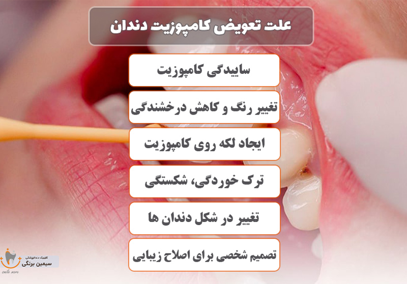 علت تعویض کامپوزیت دندان