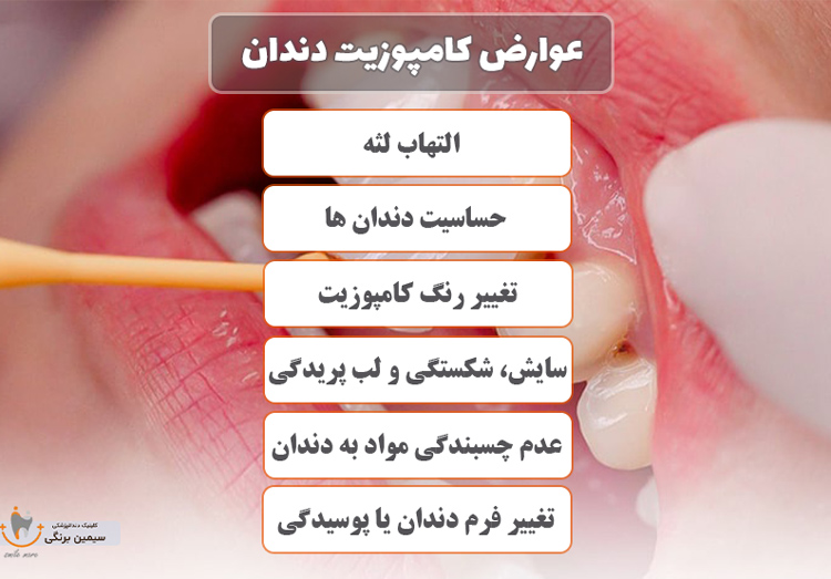 عوارض کامپوزیت دندان