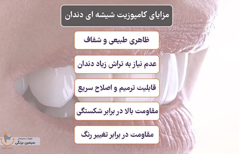 مزایای کامپوزیت شیشه ای دندان