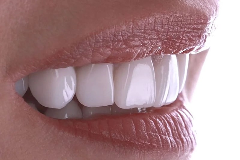 لمینت ایمکس emax