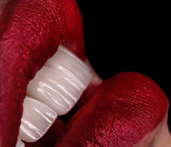 لمینت دندان ایمکس