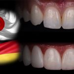 کامپوزیت آلمانی یا ژاپنی